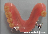 Removable partial denture
