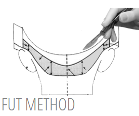 fut-method