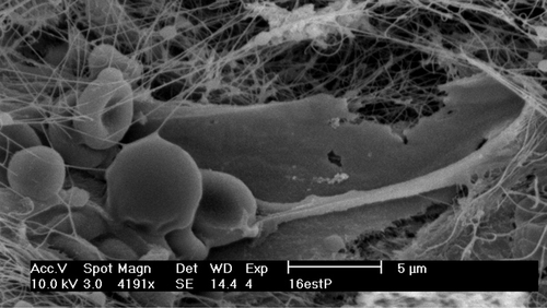 csm_ps_clinical_histo_REM