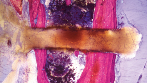 csm_ps_clinical_histo_saw